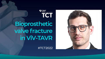 #TCT2022: Frequency and safety of bioprosthetic valve fracture in patients undergoing ViV #TAVR for failed surgical valves using the SAPIEN 3/Ultra Valves: Insights from real-world data 📉📈 Read this review ✍️🏽by @PighiMichele: pcronline.com/News/Whats-new… #cardioed