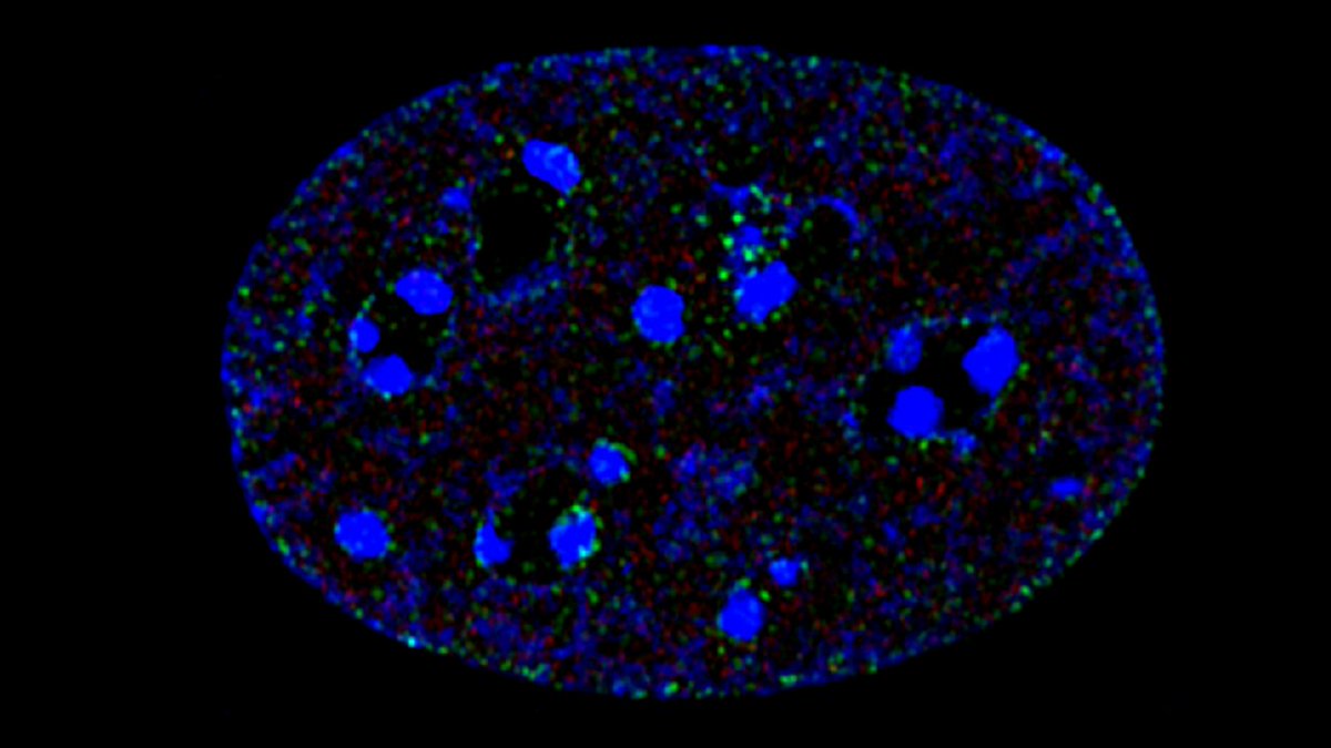 Looking forward to Micron Advanced Practical Course <a href="/UniofOxford/">University of Oxford</a> - hope it will help us get the best of our <a href="/zeiss_micro/">ZEISS Microscopy</a> Elyra 7 with SIM <a href="/UAM_IBMiB/">IMBB AMU Poznań</a>! Below one of the first SIM images by of my postdoc <a href="/AnnaPiaszyk/">Anna Piaszyk-Borychowska</a>. #microsim2022 #superResolution #SIM <a href="/LSchermelleh/">Lothar Schermelleh</a> <a href="/MicronOxford/">Micron Bioimaging Facility</a>