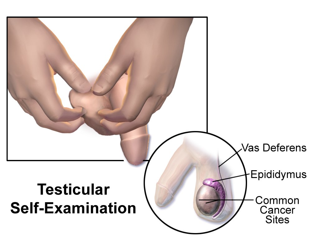 thebiohacker100's tweet photo. Hereβs the Sexual Health Self-Exam You Should Be Doing
https://t.co/IYcu858Qea
#testicleexam #testicularcancer https://t.co/YPoe3QOPB4