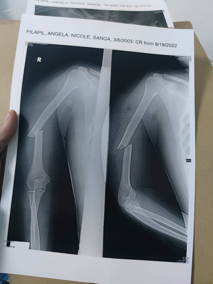 Hello everyone, I’m asking for your help to raise funds for my friend @Dazai_sol as she went through a horrible car accident yesterday. Any amount of donations would be a big help for her to go through the needed surgery.  Ty

addy: 
9CmoZPD66PYi5uPz9cMmS2RrLX5Zh4BKDid53sRysBsj