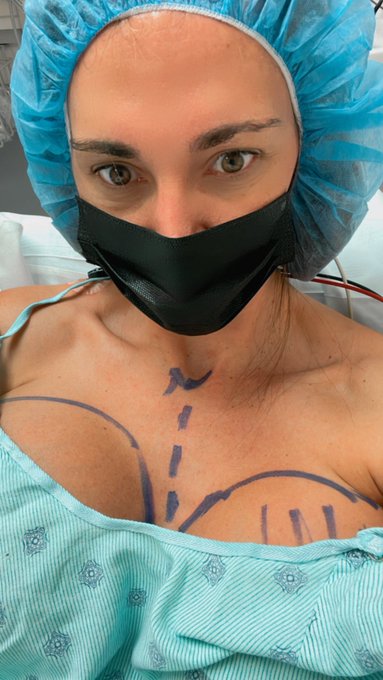Surgery with Dr. Revis in Fort Lauderdale went great!! I’m resting at home now, thank you so much for
