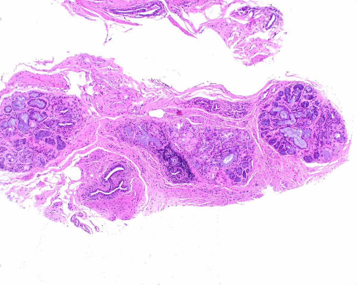 LizMontgomeryMD's tweet photo. Salivary gland heterotopia of the rectum.  Is this like having one's head _______? https://t.co/Dho27pSnH4