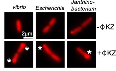 3 of the novel immune systems consists of JukA homolog only, suggesting a single-component immune system. Fluorescence tagging shows that these three JukAs still serve as sensors by localizing to infection site upon infection (* labeled). 14/n