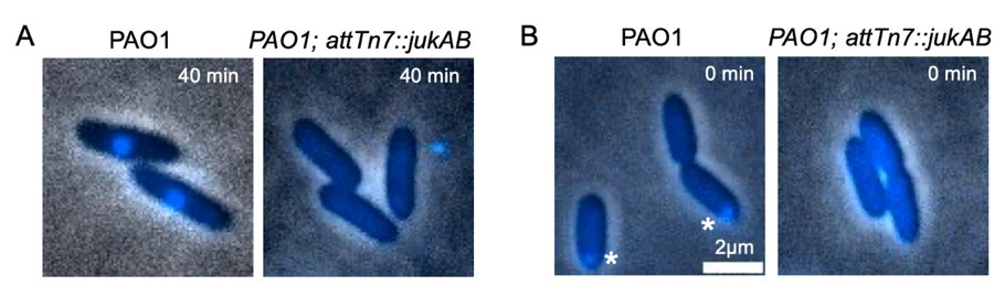 With limited info, we resorted to microscopy to study Juk mechanisms: with jukAB, A) phiKZ infection is neutralized before nucleus formation, and B) ejected phiKZ genome disappears. qPCR & RT-qPCR also confirms phiKZ DNA and RNA decreases with jukAB. Thus, Juk acts early. 7/n