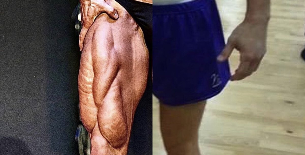 GenerationIron's tweet image. PNBA Mitch Jarvis on why you shouldn’t blame genetics for skinny legs. 

Click the link below to see how he underwent his massive leg transformation! 

generationiron.com/mitch-jarvis-g…

#naturalbodybuilding #legtransformation #muscle