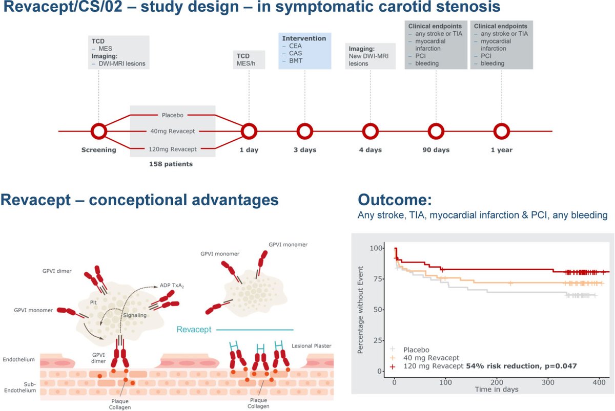 StrokeAHA_ASA's tweet photo. #STROKE Adjuvant #Revacept reduced the combined outcome of safety and efficacy in patients with symptomatic #ICAstenosis in a phase II placebo-controlled trial https://t.co/gTeQU6Rf0P @TimoUphaus https://t.co/n33q8iG1F1