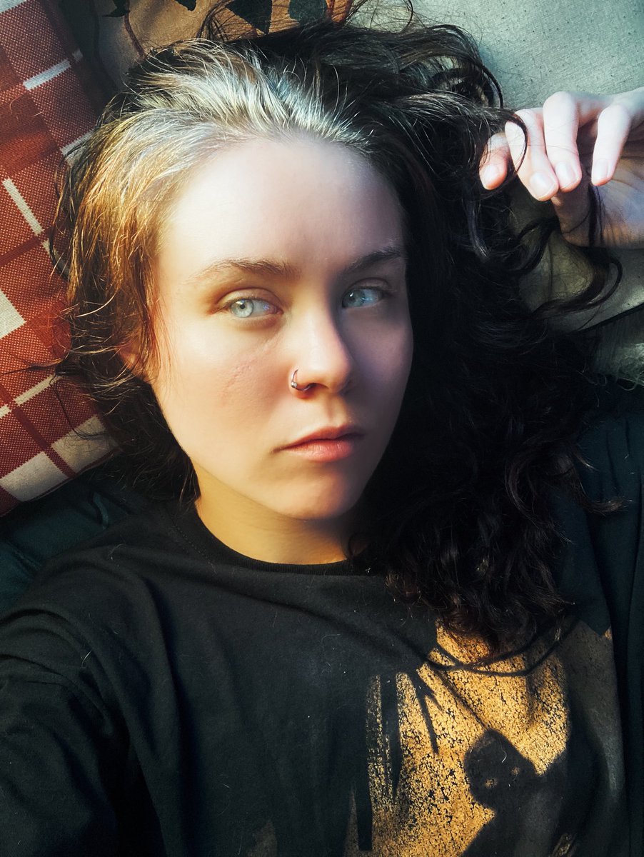 Wynter_Star_'s tweet photo. Someone said face scars are hot, I have 4. Does that mean my hotness is ranked at quadruple on the hotness scale? Or does it mean I have a very traumatic life? #scars #facescars #model #NaturalBeauty https://t.co/61I3aEAYdk