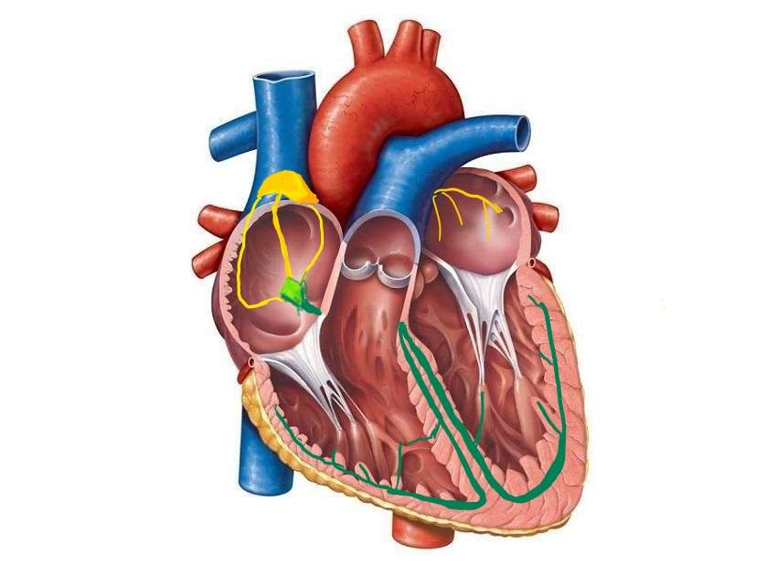 ChartAcademy's tweet photo. New to EP?
Start with the Building Blocks, become a GURU!

Cardiac Properties are:

Automaticity: 
Excitability:
Conductivity: 
Contractility: 

#EPeeps #LearnEP #cardiacelectrophysiology #conductionsystem #EPcourse #arrhythmia #tachycardia #AFIB 

https://t.co/5FSAQEvrkl https://t.co/x8IAXYb8PQ