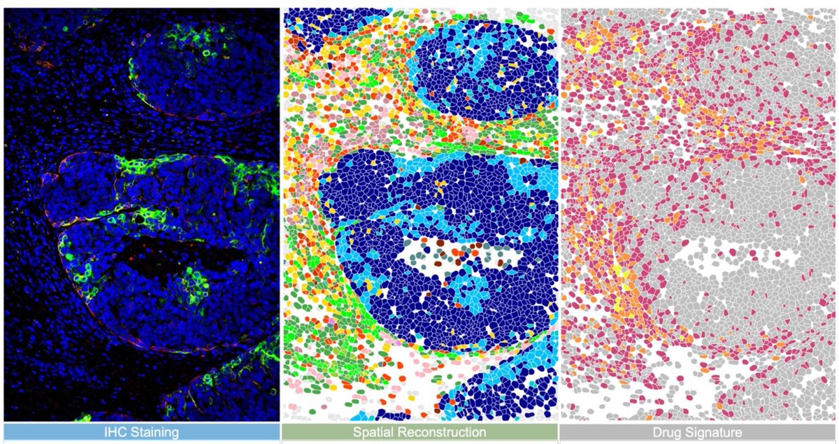 In honor of #worldcancerresearchday, see how <a href="/PresageBio/">Presage Biosciences</a> is advancing development of new cancer drugs through detailed understanding of tumor response in an entirely novel approach to clinical trials. Taking #spatialbiology to the next level! 
#Ph0 #CIVO #nanostring #cosmx #tme