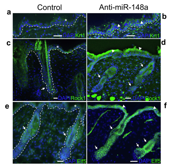 DermalCell's tweet photo. Scientists in the @DrAhmedLab at @TrentUni showed that #microRNA-148a plays an important role in regulating skin homeostasis and hair follicle cycling.

#OpenAccess - read the whole paper below 👇.
https://t.co/wJJv1vJ5zG https://t.co/DyQxkTnlDW
