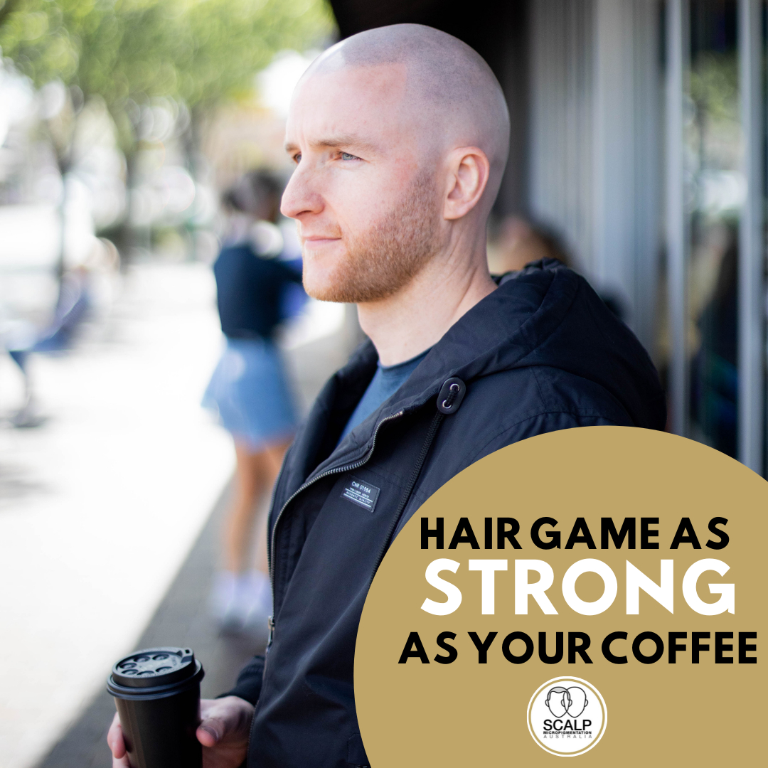 SMP_Australia's tweet photo. Scalp MicroPigmentation Australia was created in 2015 and is one of Australia's most recognised companies as a quality Scalp MicroPigmentation provider. 

@anita.smpaustralia @ari.smpaustralia @caitlin.smpaustralia @claudia.smpaustralia @emma.smpaustralia @maria.smpaustralia @sam https://t.co/YSR4WNg5Un