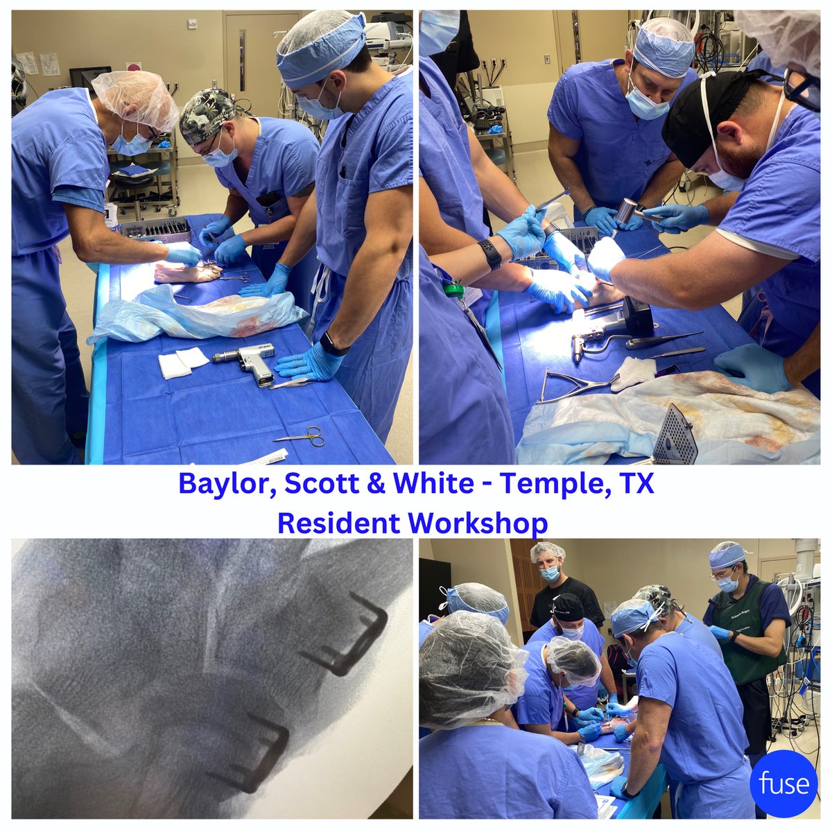 Fuse_FZMD's tweet photo. @BSWTemple_POD Thank you Dr Murdoch, Dr Browning, Dr Lynch, and Dr Felix at Baylor Scott &amp; White for brining #FuseORBITUM into to your Resident Training Program! Thank you to Dr Robert Weinstein for your always engaging instruction! #podiatry #footandankle #FZMD #podiatryresident https://t.co/gzvG3o5TLI