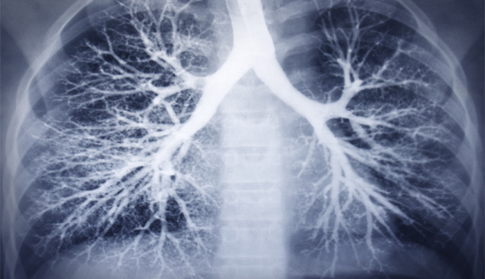 copd_2022's tweet photo. #All-cause #mortality in #individuals with #COPD was strongly predicted by #diffusing capacity #independent of #computed tomography evidence of #emphysema and #airway wall thickness and #BODE index, according to  Annals of the #American Thoracic #Society. https://t.co/dHEW2fL3fm