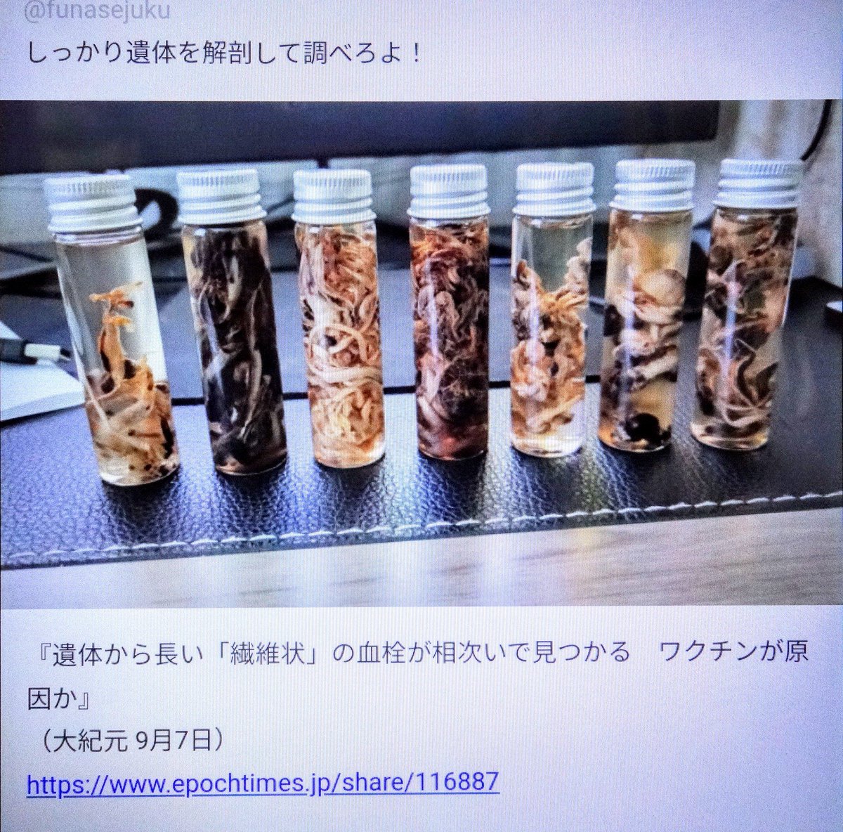 barbie_oneness's tweet photo. @love_nausicaa @fxi9ttSrGrL5Hnx 間違いないでしょう　ワクチン打って死んだ人を
わざわざP検査する必要無いのに陽性扱いして
誰にも触らせないようにしてるのは
遺体解剖して血管から大量の血栓寄生虫が
出てくるとワクチンにとんでもないものが
入っていたとバレるからさ
寄生虫どころか得体の知れない生命体まで
次々出てくる😱 https://t.co/qrh83T0nbg