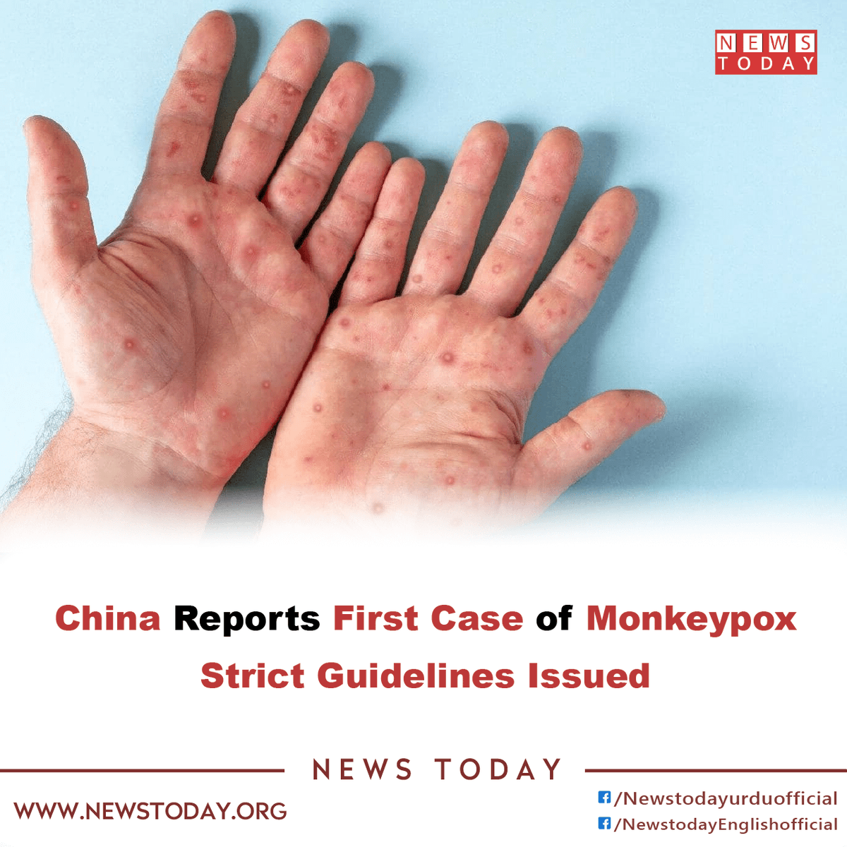 newstoday_org's tweet photo. The discovery of the first case of monkeypox in China, a top health official advised the public to avoid personal contact with foreign nationals.
Read More:
https://t.co/jwoRCMDUP5
#newstoday #china #monkeypox #monkeypoxcases #monkeypoxvirus #BreakingNews https://t.co/pCXEiC6W3H