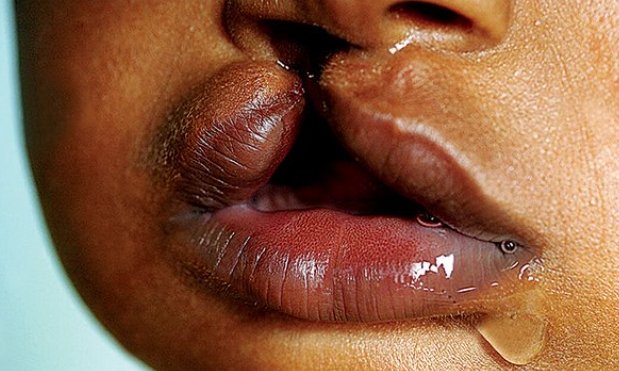 Se conheces crianças de 5 aos 14 anos de idade, com lábio leporino ou fenda do palato, que necessita cirugia, encaminhe ao hospital Josina Machel, área de cirugia maxilo facial, cave porta 26. Até ao dia 30 de setembro (gratuito)