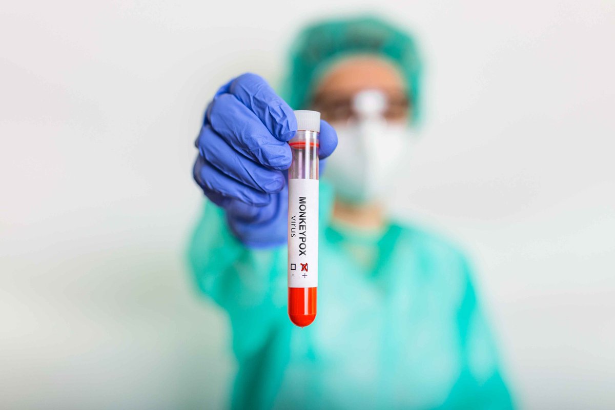 docthub's tweet photo. US reports 24,000 #monkeypox cases
Read more - https://t.co/I6ptL9wfHT
#monkeypox #monkeypoxupdate #diseases #USA #medical #healthcare #HealthyLiving https://t.co/XhpHbIYe2q
