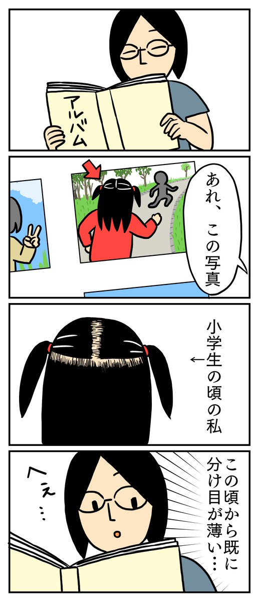 子供の頃から薄かったんだなぁ。みつを
#実録
#薄毛 