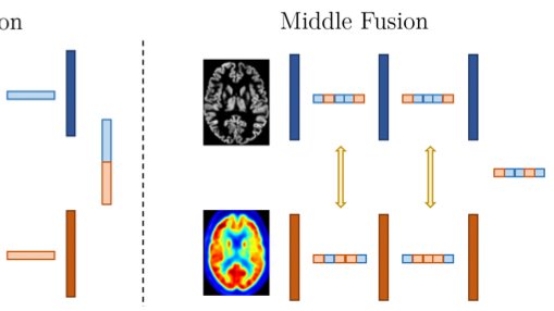 Fusing MRI and FDG-PET for Alzheimer's classification should work better than each modality alone. Surprisingly, our results on ADNI tell a different story. So, Is PET all you need? Check out the poster at #MICCAI2022
arxiv.org/abs/2207.02094