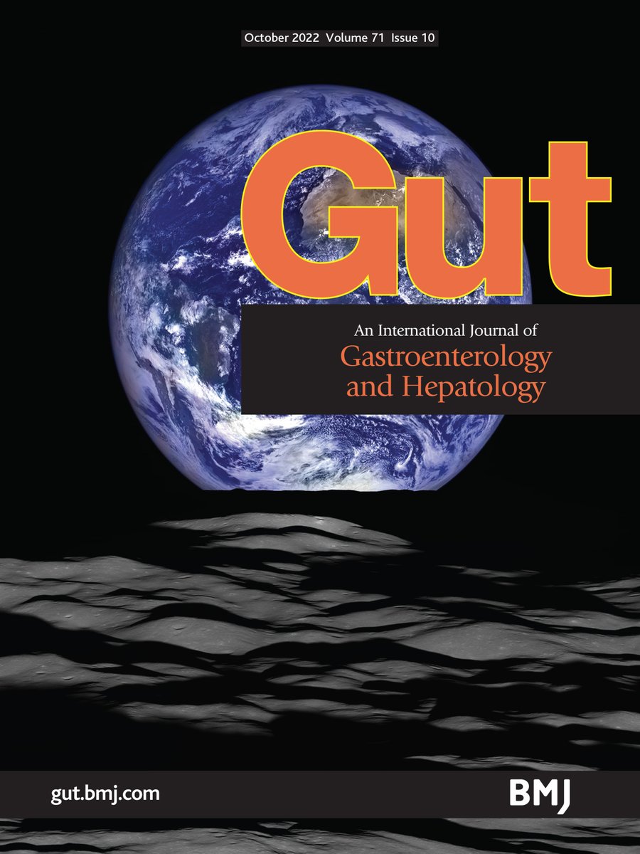 Gut Journal (@gut_bmj) on Twitter photo Iconic NASA image of our beautiful Earth. Read in this issue of <a href="/Gut_BMJ/">Gut Journal</a> the Commentary by Leddin et al highlighting the views on #ClimateChange from global GI societies & their plans to tackle the climate crisis via bit.ly/3BEGORi
<a href="/WorldGastroOrg/">World Gastroenterology Organisation (WGO)</a> <a href="/BritSocGastro/">BSG</a> Iconic NASA image of our beautiful Earth. Read in this issue of <a href="/Gut_BMJ/">Gut Journal</a> the Commentary by Leddin et al highlighting the views on #ClimateChange from global GI societies & their plans to tackle the climate crisis via bit.ly/3BEGORi
<a href="/WorldGastroOrg/">World Gastroenterology Organisation (WGO)</a> <a href="/BritSocGastro/">BSG</a>