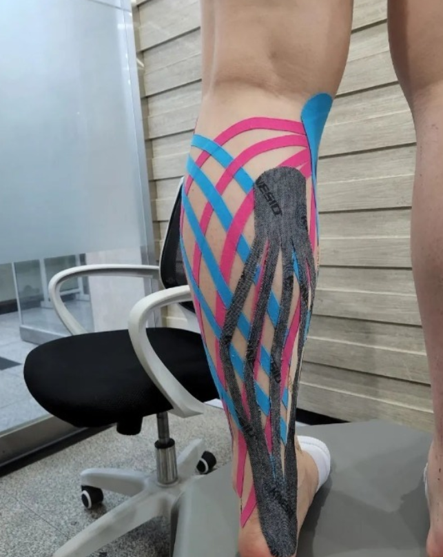 Kinesio_UK's tweet photo. #Repost by @ryusangkyun_
Fantastic taping application using a mix of #Kinesio FP & Performance taping range.
#Kinesiotapingmethod https://t.co/8sU1QX7Ifl