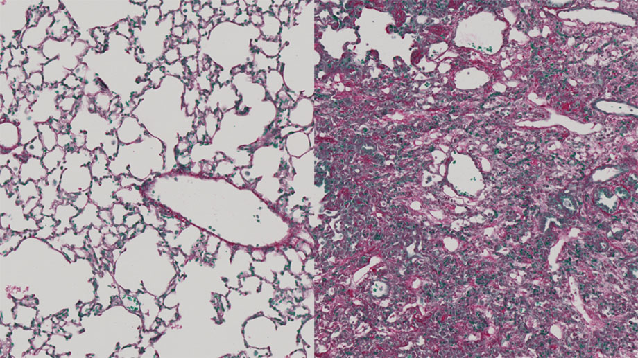 SKINTEGRITY.CH (@skintegritych) on Twitter photo π§΅ 1/2 #chronicdisease often leads to #fibrosis. The <a href="/StockmannLab/">Stockmann lab UZH Anatomy</a> <a href="/UZH_en/">University of Zurich</a> and colleagues developed an #immunotherapy that specifically targets the cause while leaving normal tissue cells unharmed. This could lead to an effective #treatment for fibrosis!
doi.org/10.1016/j.stem⦠𧡠1/2 #chronicdisease often leads to #fibrosis. The <a href="/StockmannLab/">Stockmann lab UZH Anatomy</a> <a href="/UZH_en/">University of Zurich</a> and colleagues developed an #immunotherapy that specifically targets the cause while leaving normal tissue cells unharmed. This could lead to an effective #treatment for fibrosis!
doi.org/10.1016/j.stemβ¦