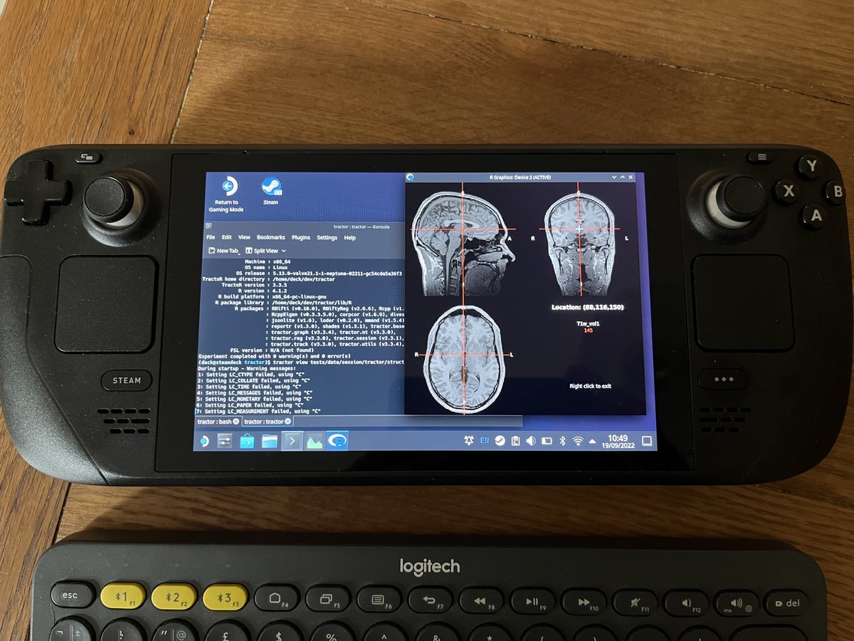 jonclayden's tweet photo. The Steam Deck really is a flexible mini-PC. It can even run medical imaging software, if that happens to be a thing you want… https://t.co/eB9ntUEIJB @tracto_r @OnDeck https://t.co/AS650UAVih