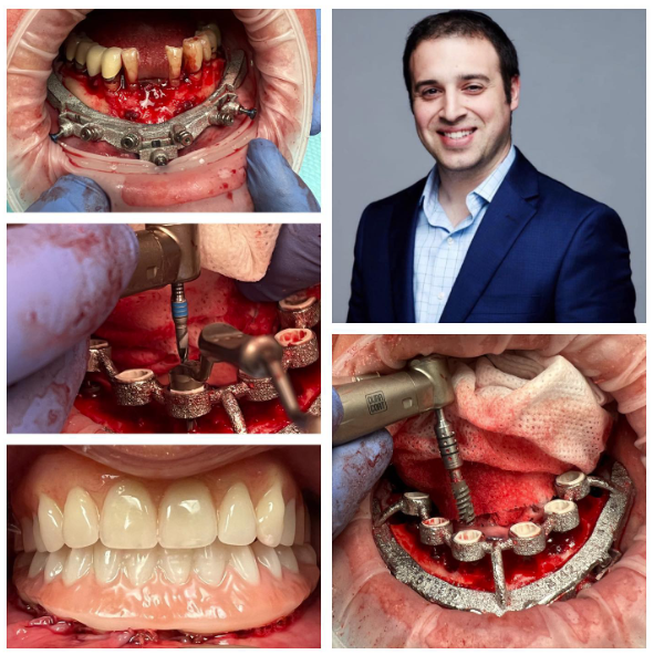 ROE Dental Lab tweet media