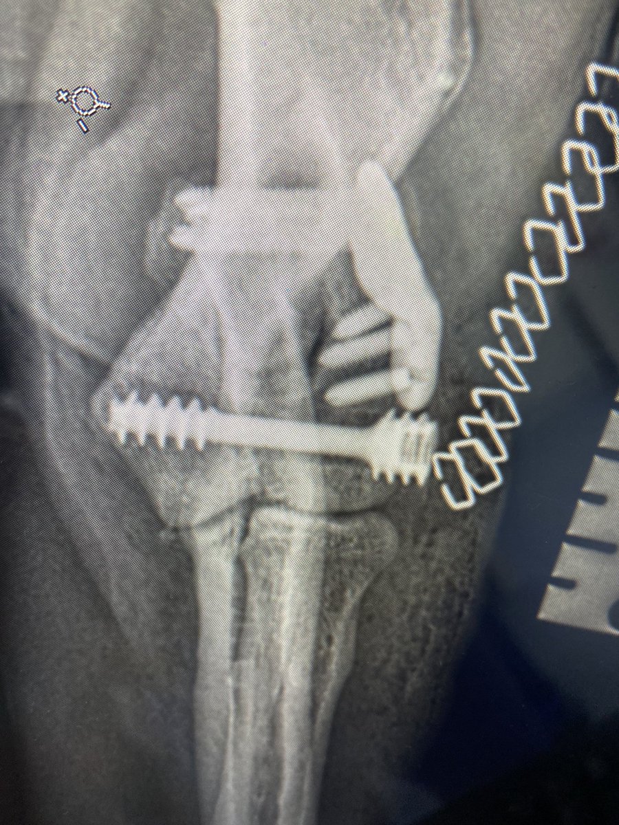I’m off to #ESVOT in Nice. Yesterday I did some clinical work on a lovely Springer Spaniel using innovative implants produced by <a href="/FusionImplants/">Fusion Implants</a>, a spin out from <a href="/LivUni/">University of Liverpool</a>. In my opinion, the implants make surgery easier and more precise. Collaboration between engineers and vets 👍