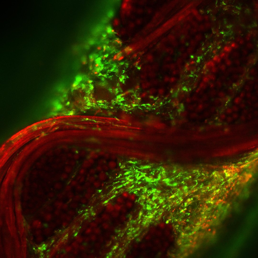 CytexOrtho's tweet photo. Take a closer look! This image shows cells (in green) moving into the top layers of CytexOrtho's implant (in red). The green cells are developing functional tissue as the implant dissolves.
#Innovation #TissueEngineering #RegenerativeTechnology #3Dweaving #3Dprinting #CytexOrtho https://t.co/87wYjE1tfI