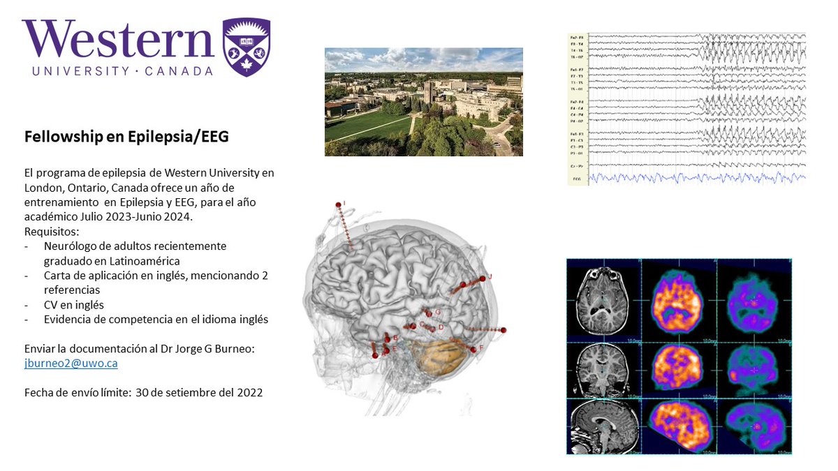 epileptologo's tweet photo. La fecha límite está cerca. Si eres neurólogo o neuróloga recién egresado en Latinoamérica, considera aplicar #epilepsia https://t.co/QL4Xibd3wM