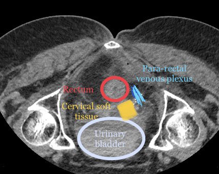 Endovascular Rounds tweet media