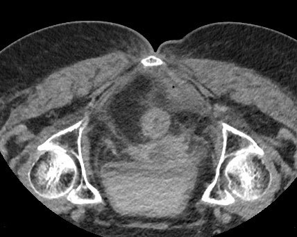 Endovascular Rounds tweet media