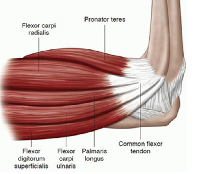 drdozellodc's tweet photo. Two Minutes of Anatomy: Anterior Forearm Muscles
Dr Donald Ozello DC 
#vegas #chiropractor #chiropractic #sportsmedicine #anatomy #anatomyandphysiology #forearm #forearmmuscles #anteriorforearm #wristflexors #wristflexion #forearmpronation #elbowpronation https://t.co/y26a7jwwQS https://t.co/eBVIJqFtC2