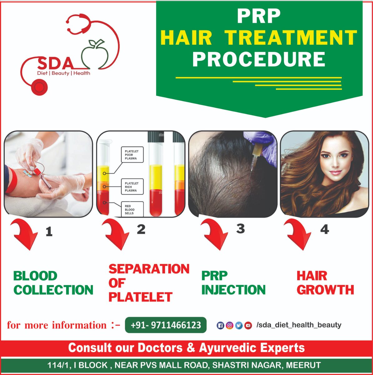 HealthSda's tweet photo. PRP #hair Treatment Procedure
1- Blood Collection
2- Separation of platelet
3- PRP #Injection
4- Hair Growth
Consult Now
Get Expert Advice by #Dr_Sonal_Dhingra_Anand
call now: 09711466123
#SDA #Diet #Health #Beauty #nutrition #tips #foods #Vegetables #Vitamin #implants #hairstyle https://t.co/YyUIbQFJhn