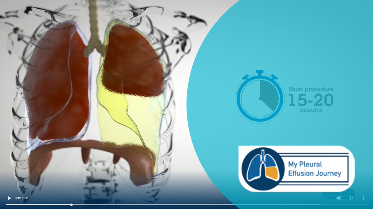 My Pleural Effusion Journey is a great patient information and decision tool this is for patients with a malignant pleural effusion - co-produced by patients and families affected by this condition.

Access online ▶️ow.ly/ihQA50KLfjM