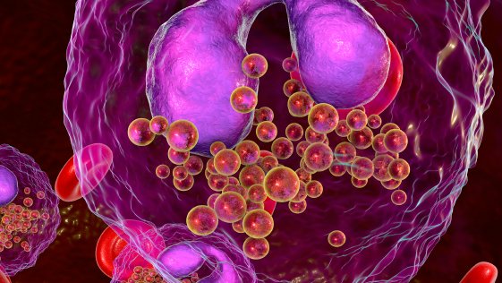 DeceraClinIns's tweet photo. Join us Sept 21 as @CyrusKhann  presents clinical efficacy and safety data supporting the use of a selective Bruton tyrosine kinase inhibitor for the treatment of previously untreated and R/R  CLL. Claim your seat! https://t.co/lz8rvqXDhx #hematology #oncology https://t.co/NN6wSEn3bZ
