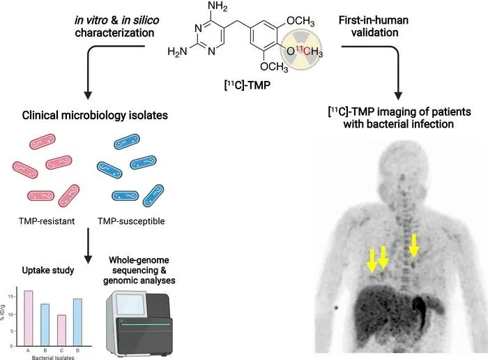 Journal of Clinical Investigation (@jclinicalinvest) on Twitter photo #ClinicalMedicine: Radiolabeled trimethoprim reveals drug-sensitive and drug-resistant bacterial infections: buff.ly/3r2MMpn
<a href="/sellmyerlab/">sellmyerlab</a> <a href="/PennRadiology/">Penn Radiology</a>
#InfectiousDisease
Read the related #Editor’s Note by Patrick C. Seed: buff.ly/3UhemML #ClinicalMedicine: Radiolabeled trimethoprim reveals drug-sensitive and drug-resistant bacterial infections: buff.ly/3r2MMpn
<a href="/sellmyerlab/">sellmyerlab</a> <a href="/PennRadiology/">Penn Radiology</a>
#InfectiousDisease
Read the related #Editor’s Note by Patrick C. Seed: buff.ly/3UhemML