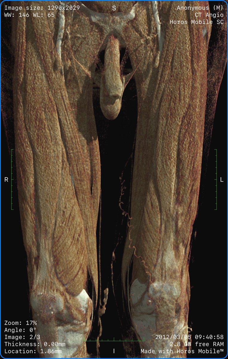 Horos Mobile™ tweet media