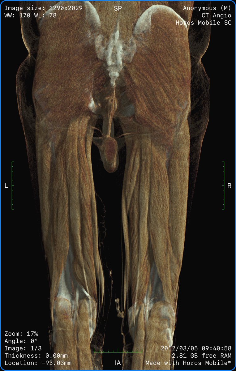 Horos Mobile™ tweet media