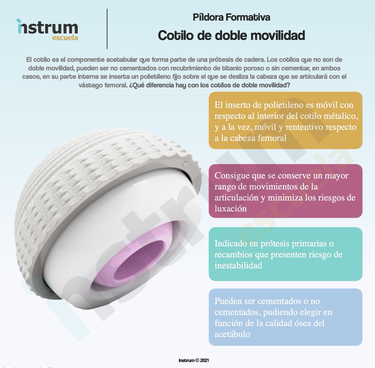 instrum_es's tweet photo. Los cotilos de doble movilidad cada vez son más utilizados en las artroplastias de cadera porque gracias a ellos, se pueden reducir los episodios de luxación.
#instrumescuela #surgicalnurse #quirofano
https://t.co/LfgCfuhE3n https://t.co/3tY4BjBFAu