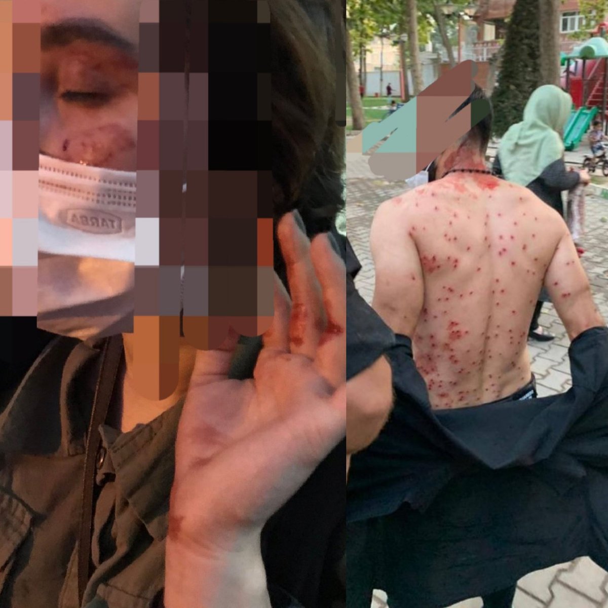 Hey, ich bin aus dem Iran. Wir im Iran werden verhaftet, geschlagen, ausgeraubt und sogar von der moralischen Sicherheitspolizei getötet, wenn wir keinen Hijab tragen.