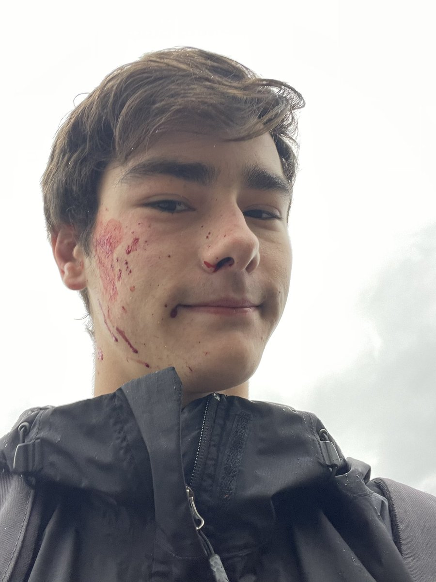 TxgrrTV's tweet photo. Fuck hydroplaning. Bounced off the median across 3 lanes and got hit by a tanker truck. Genuinely lucky to be alive. 4 broken ribs and a broken shoulder blade. Be safe out there everyone :( https://t.co/Cdm7OG3xQM