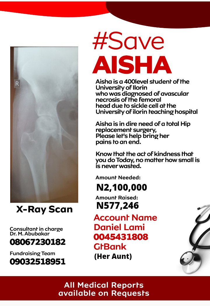 thepatients_pt's tweet photo. Hey, there. We haven't given up on #SaveAisha. And we trust you haven't too. So, have you shared the flier today?Have you donated to #SaveAisha yet? Remember that even if you helped before,you can help again today,please.
Please, donate & share:
0045431808 |Daniel Lami|GTB https://t.co/jSpjEHCRsy