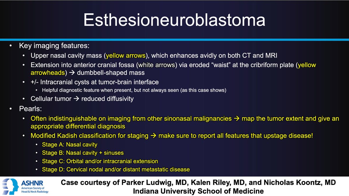 #ASHNRCOTW #202 ANSWER: Esthesioneuroblastoma! Thx Drs. Ludwig, @KRileyMD, & @nakoontz @IURadiology 4 case! #ASHNR23 @callyrobs @nancyfstanford @DShatzkes @CDP_Rad @rhwiggins @cmtomblinson @WmOBrienDO @ESHNRSociety @CMGlastonbury @tabby_kennedy @PhilipRChapman1 @AnnJayMD1