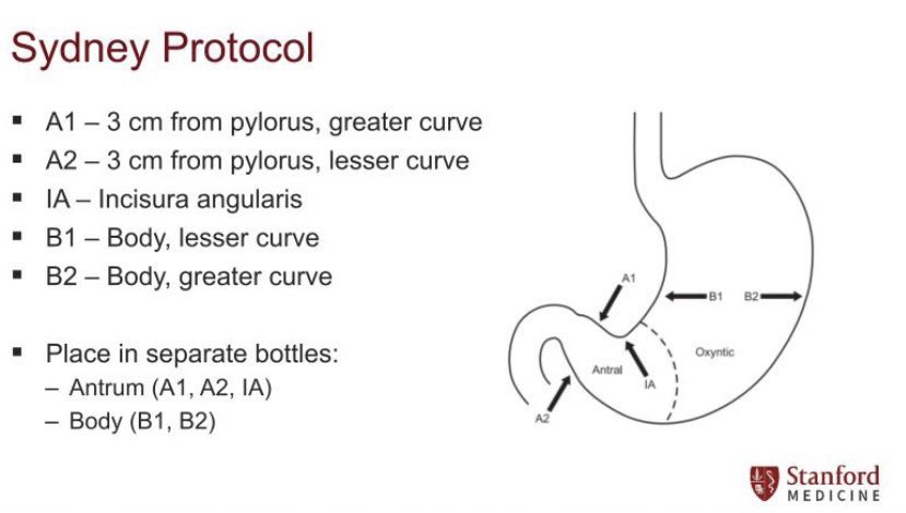 drkeithsiau's tweet photo. Sydney protocol biopsies for gastric atrophy / intestinal metaplasia 🎯 #GITwitter https://t.co/oA9yCCNwwx