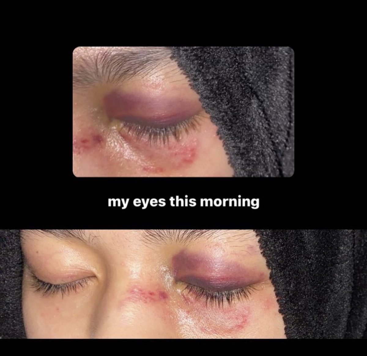 mighvv's tweet photo. Abusive parents do exist. 

Kesiannya dekat adik ni. Ya Allah 💔
Kalau korang tahu macam mana nak reach adik ni please let me know. Kita sama-sama bantu apa yang boleh. Instagram dia tak boleh DM. 🙁 https://t.co/02Tsy4rUot