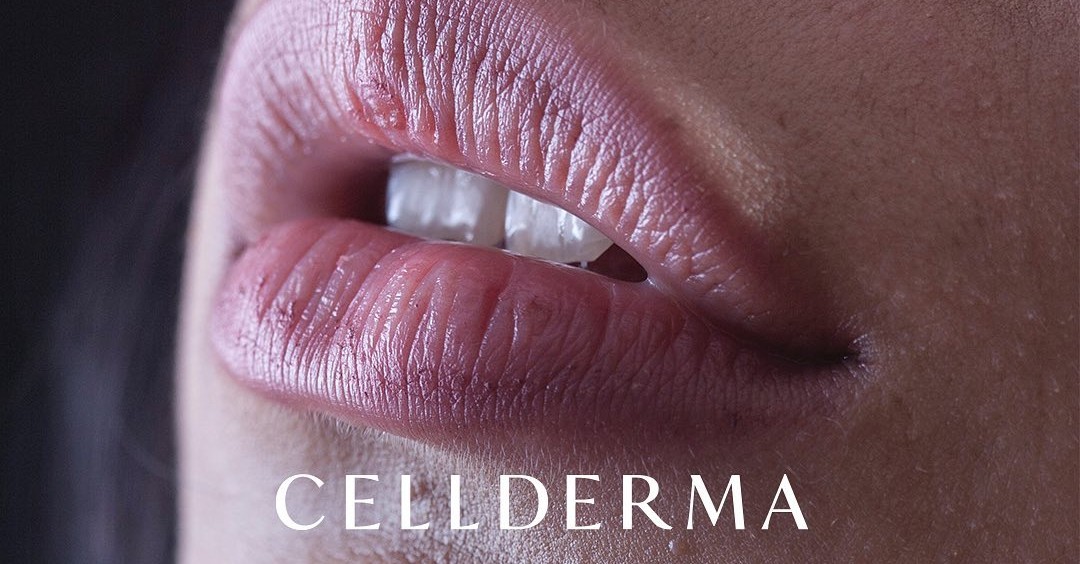 SereneAmanda's tweet photo. Pucker up buttercup! 👄🌼
With #CellDerma Perfect Lips plumping balm we have the perfect remedy for those winter lips.

Contact Amanda today to book your skin consultation.
☎️ Phone/message: 07444938248
💻 https://t.co/qvCVh60Ntu https://t.co/Ee5w0hi6DB