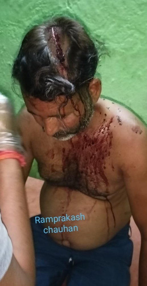 AnchalTv's tweet image. चित्रकूट में कट्टरपंथियों ने हिंदुओं को कुल्हाड़ी से जान से मारने की कोशिश की.👇