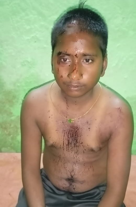 AnchalTv's tweet image. चित्रकूट में कट्टरपंथियों ने हिंदुओं को कुल्हाड़ी से जान से मारने की कोशिश की.👇